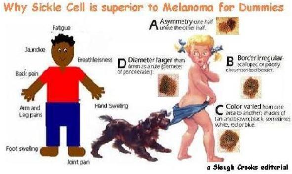 Melanoma Symptoms, Stages & Metastatic Melanoma
